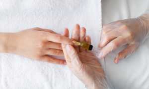 Как можно йодом вылечить грибковое заболевание эффективно и безопасно