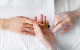 Как можно йодом вылечить грибковое заболевание эффективно и безопасно