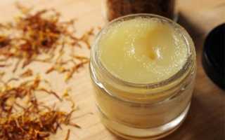 Лечение псориаза народными средствами