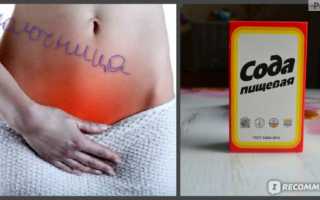 Лечение молочницы содой и йодом в домашних условиях