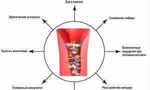 Неприятный запах при кандидозе у женщин: причины и решения