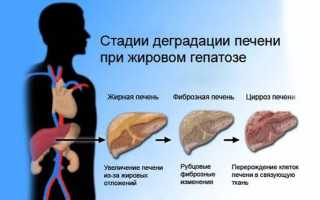 Жировой гепатоз печени