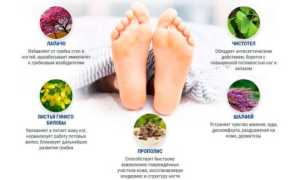 Принципы лечения грибкового поражения между пальцами ног: советы и рекомендации