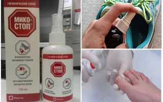 Чем лучше всего следует обрабатывать обувь от грибка? Полезные советы