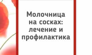 Как лечить молочницу на сосках у кормящих мамочек: советы и рекомендации
