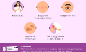 В каких случаях помогает препарат тербинафин для лечения?