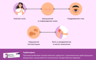 В каких случаях помогает препарат тербинафин для лечения?