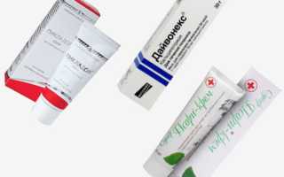 Кремы от псориаза – список лучших препаратов