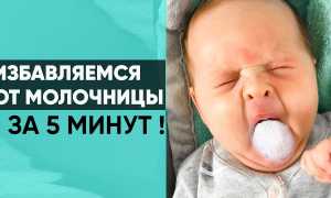 Рецепт содового раствора для лечения молочницы у новорожденных в домашних условиях