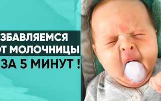 Рецепт содового раствора для лечения молочницы у новорожденных в домашних условиях