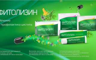 Способы лечения молочницы и цистита: рекомендации и советы