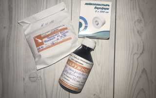 Лечение грибковых заболеваний при помощи препарата Уреапласт: эффективные методы и рекомендации