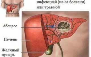 Эхогенность паренхимы печени повышена что это такое
