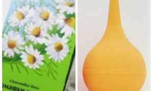 Лечение молочницы спринцеванием лекарственной ромашкой: советы и рекомендации