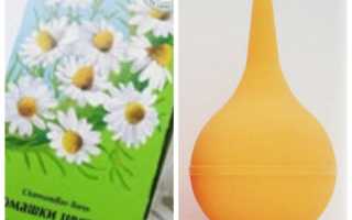 Лечение молочницы спринцеванием лекарственной ромашкой: советы и рекомендации