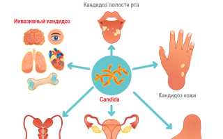 Для чего и как выполняется анализ крови на грибок в организме: важные аспекты и рекомендации