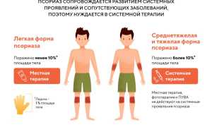 Лечение псориаза с применением Фолиевой кислоты: эффективные методы и рекомендации