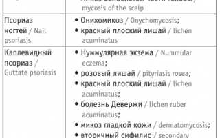 Особенности протекания псориаза у детей: важные аспекты и рекомендации