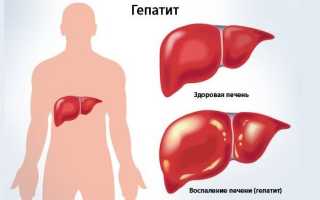 Аутоиммунные заболевания печени