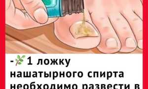 Проверенные рецепты с чесноком для борьбы с грибком ногтей в домашних условиях