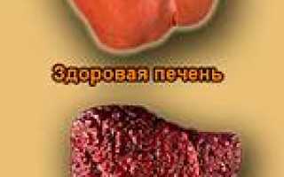 Чистим печень в домашних условиях