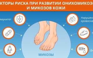 Особенности лечения грибковой инфекции ногтимицином: важные аспекты и рекомендации