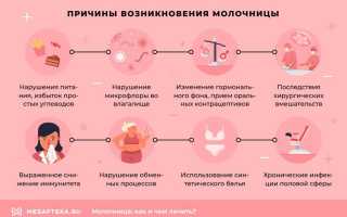 Что такое молочница и какие причины её возникновения, а также способы профилактики