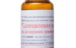 Средство от кожного заболевания псориаз — салициловая мазь для эффективного лечения