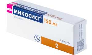 Выбор мазей для лечения молочницы у мужчин: советы и рекомендации