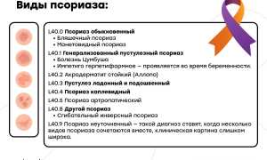Все об ушном псориазе — особенности заболевания, его лечение и профилактика