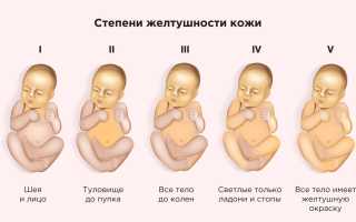 Прямой билирубин повышен у ребенка