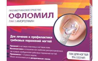 Как бороться против грибка ногтей офломил лаком? Полезные советы и рекомендации