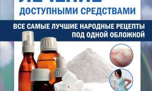 Как в домашних условиях вылечить грибок обыкновенной содой эффективно и безопасно