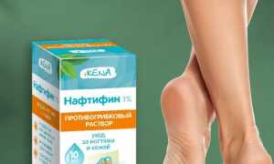 Как при помощи нафтифина можно победить грибок? Полезные советы и рекомендации