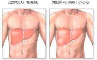 Увеличение печени лечение