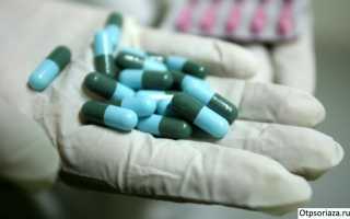 Как лечить ладонно-подошвенный псориаз?