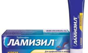 Как применять ламизил при борьбе с онихомикоз: советы и рекомендации