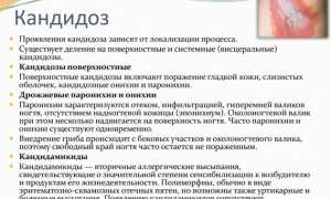 Опасность возникновения системного кандидоза: причины и последствия