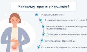 Основные советы профилактики молочницы у мужчин и женщин для здоровья