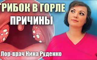 Из-за чего появляется грибок в горле и как его лечить правильно