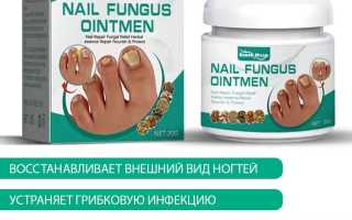 Рекомендации по использованию мазей от грибка ногтей для эффективного лечения