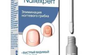 Препарат для лечения грибковой инфекции ногтей — нейлэксперт для здоровья ногтей