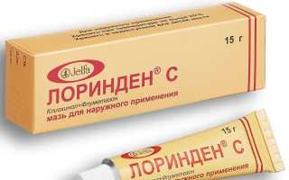 Эффективная мазь Лоринден С для лечения грибка на коже