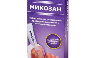 Способы лечения грибка ногтей средством Микозан для здоровья
