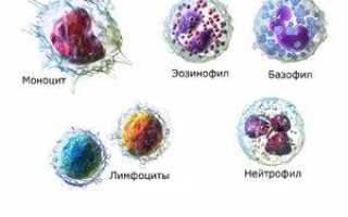 Сдвиг лейкоцитарной формулы влево