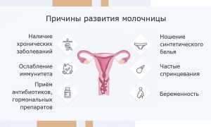 Симптомы молочницы во время менструального цикла: что нужно знать