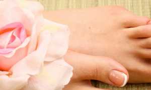 Способы борьбы с грибком при помощи недорогого препарата — Бутенафина для здоровья кожи