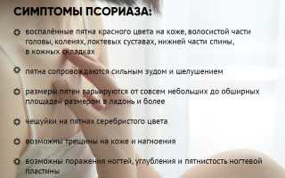 Действительно ли псориаз передается по наследству? Важные факты и исследования