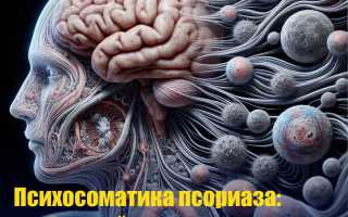 Является ли психосоматика одной из причин псориаза и его проявлений?
