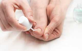 Как выбрать лечебный лак от грибка ногтей для эффективного лечения